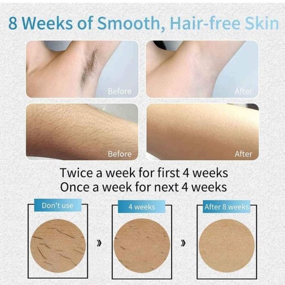 NEW Laser Hair Removal for Permanent at-Home Hair Removal Device Painless - Picture 5 of 6